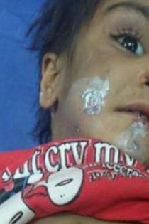 ماجرا و علت شکنجه ستایش 3 ساله در رفسنجان + عکس